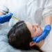 Exosomes Therapy Enhances DHI Hair Transplant Results